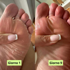 Sapone purificante antifungino Nudra®