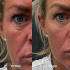 Cerotti oculari in idrogel di peptidi e collagene