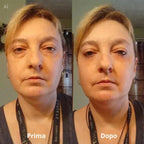 Cerotti oculari in idrogel di peptidi e collagene